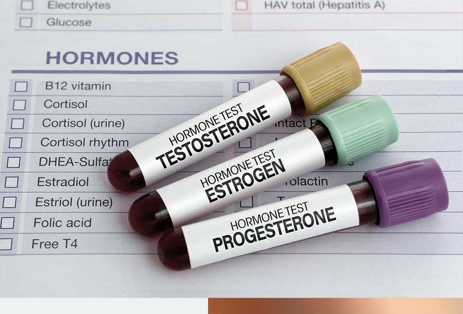 hormone tests